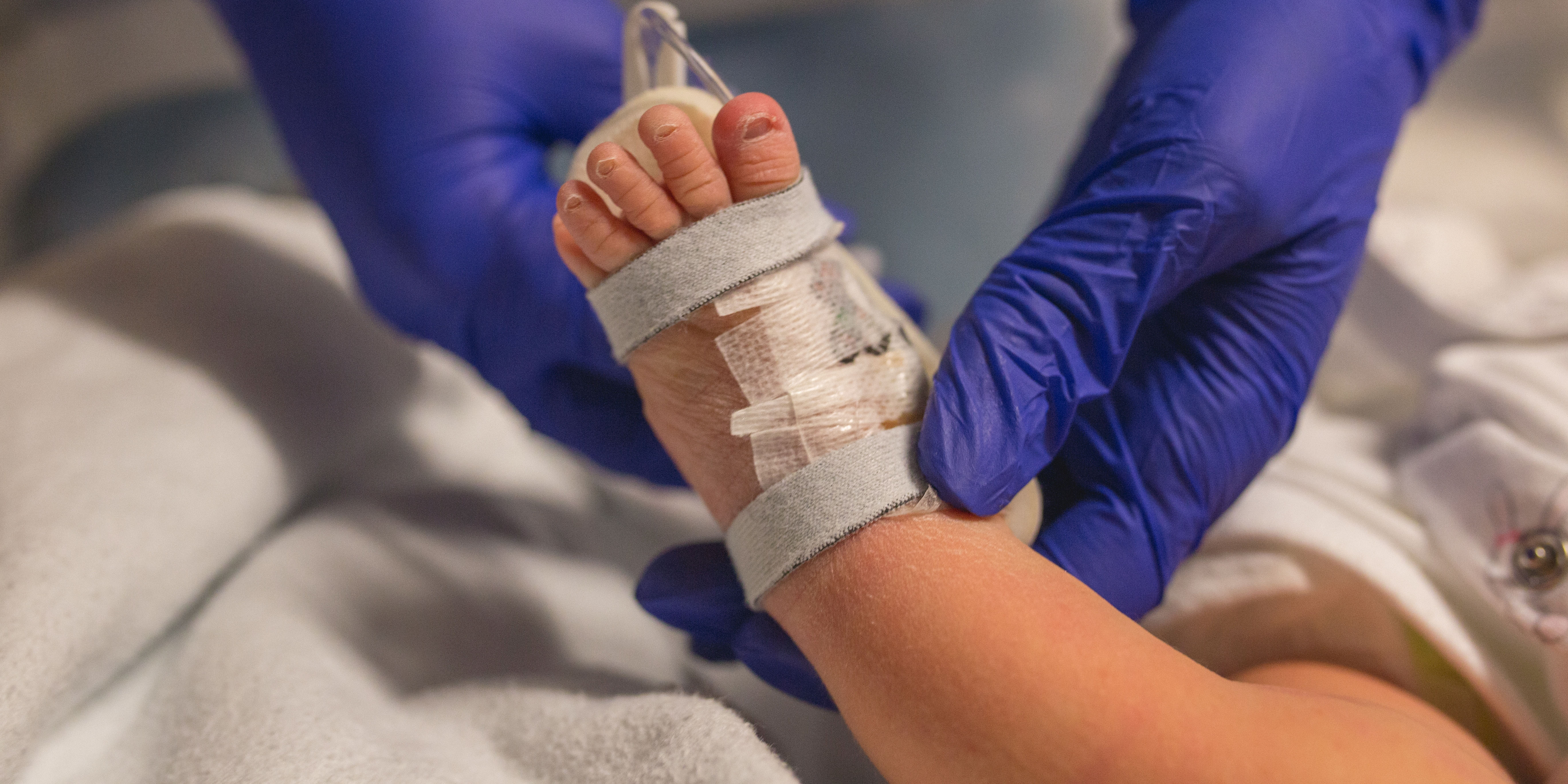 Pediatric Sepsis