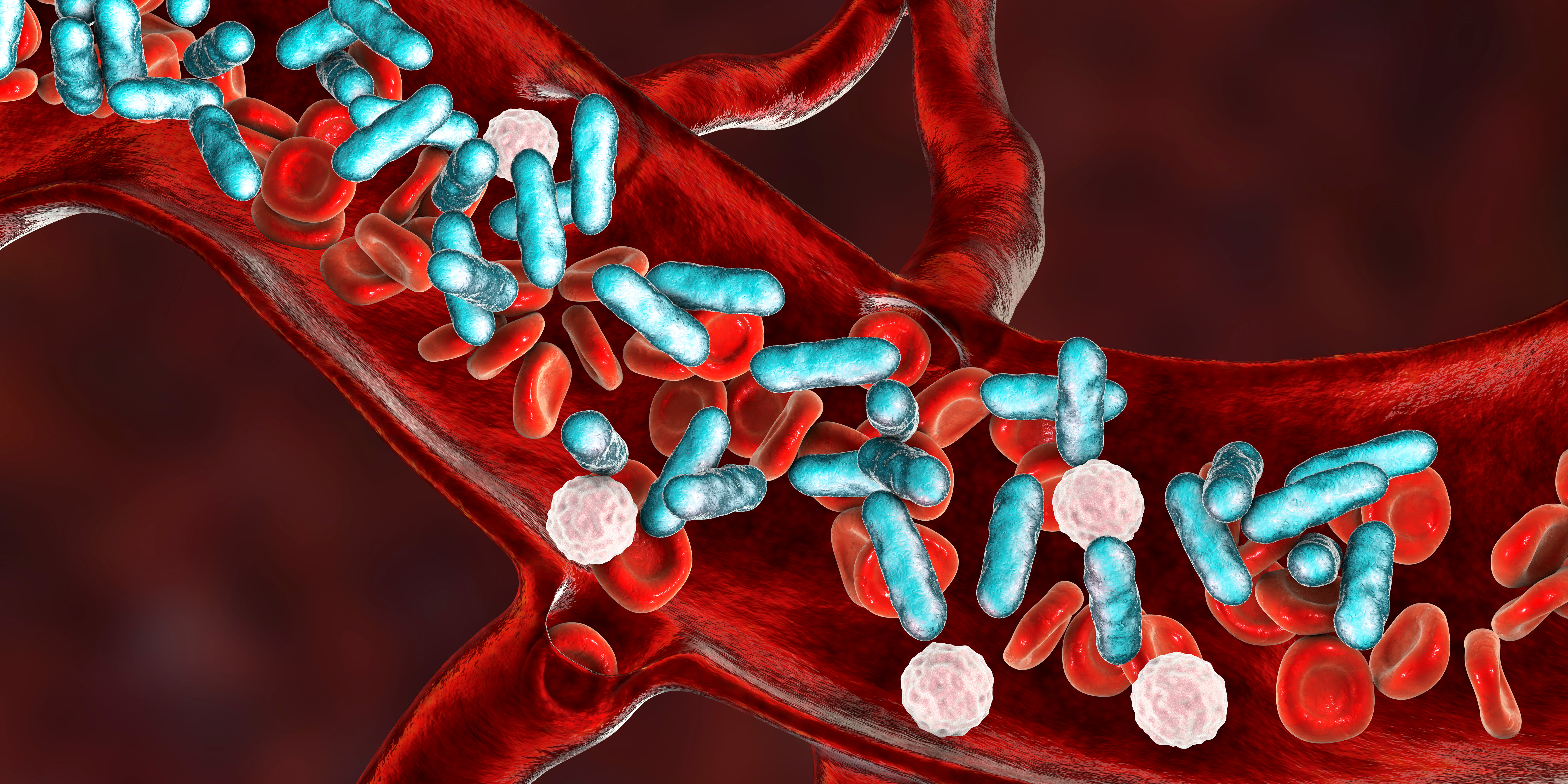 Case-Based Pediatric Sepsis