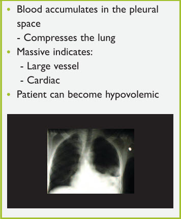 Figure 9. Hemothorax