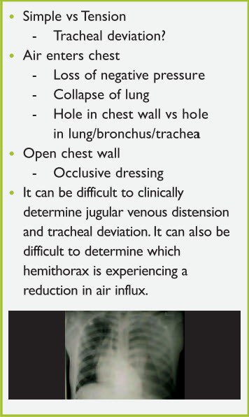Figure 8. Pneumothorax