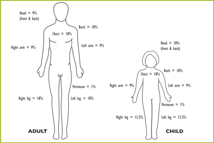 Figure 12. Rule of nines and adjustments for pediatric patients